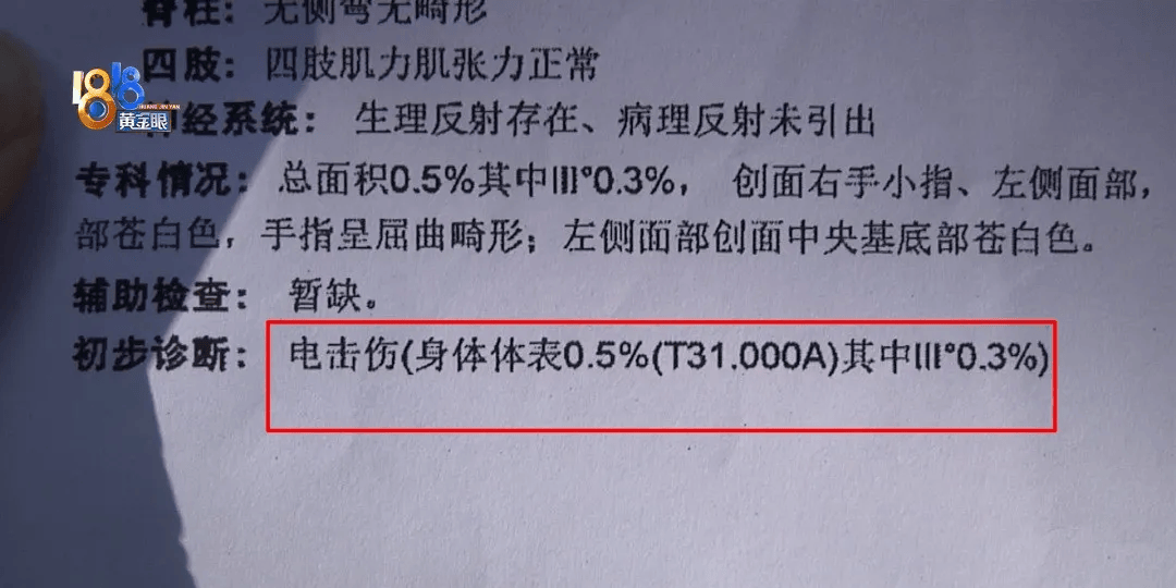 5岁男童瞬间晕厥,筋都断了!街上常见,看见立即远离