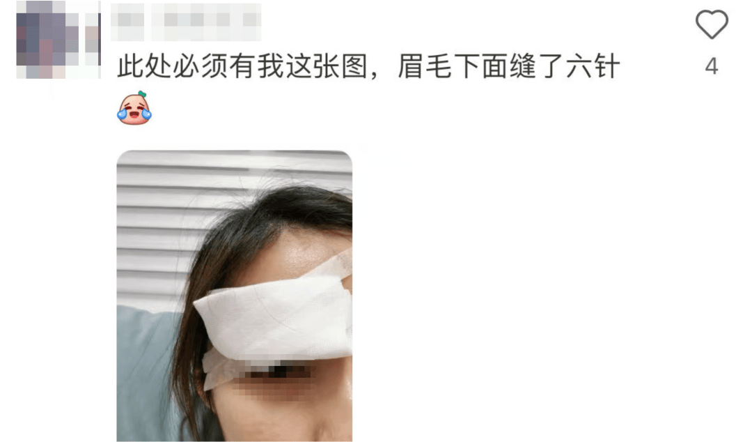 击穿眉骨、扎穿手指……这项球速达300km/h的人气运动暗藏风险！