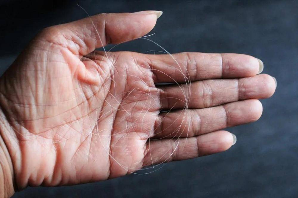 白头发拔一根长三根？到底能不能拔？终于弄清楚了