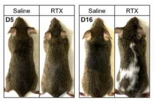 白头发拔一根长三根？到底能不能拔？终于弄清楚了
